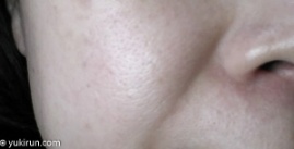 画像： 塗る前…毛穴と肌荒れが目立つヤバイ肌